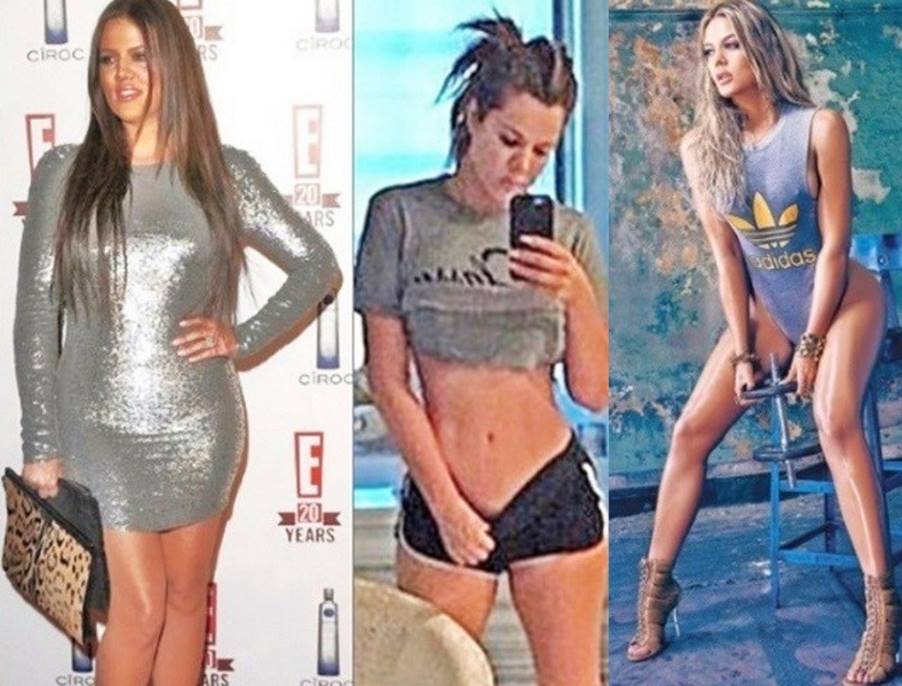 Khloe Kardashian’s Plastic Surgery